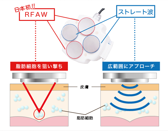 キャビテーションの仕組み