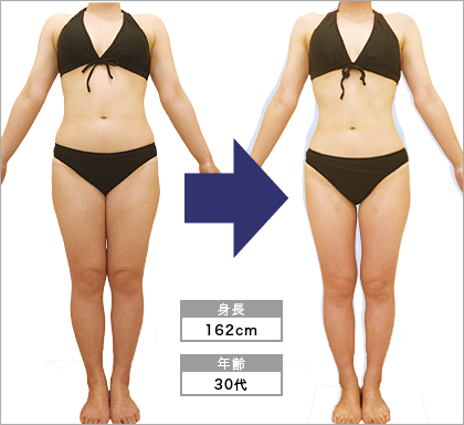 栄店Y･N様の3ヶ月での痩身ビフォーアフター（正面）