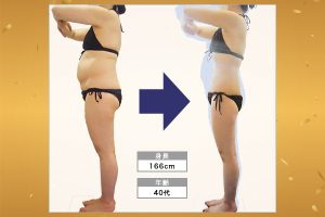 痩身エステは本当に痩せる？痩身ビフォーアフターをご紹介！