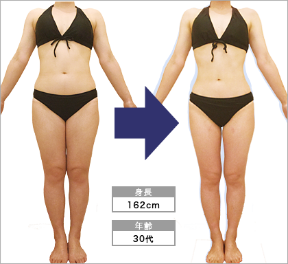 第21回美脚部門2位 栄店y N様 第21回ビューティーコンテスト 痩身エステのオリエンタル スタイル 公式サイト