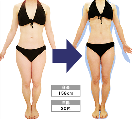 名駅店M･O様3ヶ月で太もも-6.8cm達成