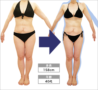 名駅店H･S様3ヶ月でウエスト-10.5cm達成