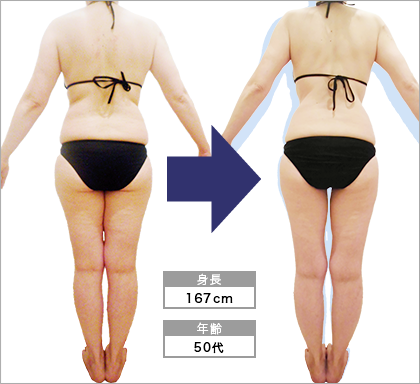 オリエンタルスタイル姫路店N･S様3ヶ月で体重-12.7kg達成