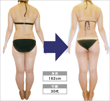 オリエンタルスタイル烏丸店M･N様3ヶ月で太もも-5.4cm達成