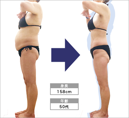オリエンタルスタイル心斎橋店M･T様3ヶ月で太もも-5.1cm達成