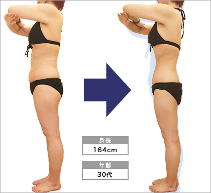 オリエンタルスタイル名駅店K･T様3ヶ月でウエスト-9.3cm達成
