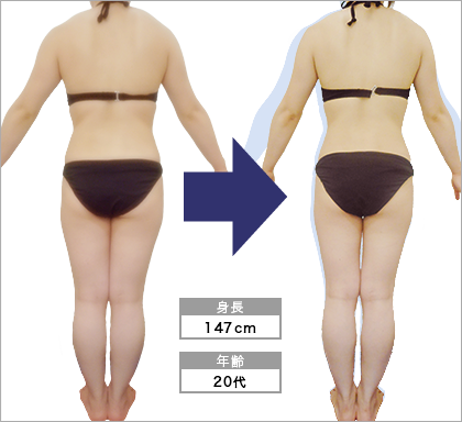 オリエンタルスタイル梅田店S･S様3ヶ月で太もも-4.0cm達成
