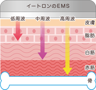 イートロンのEMSは赤筋まで届く