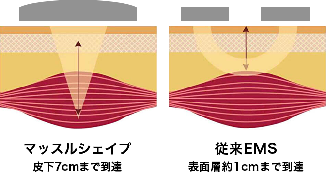 マッスルシェイプは皮下7cmまで、EMSの場合は表面層約1cmまでアプローチ